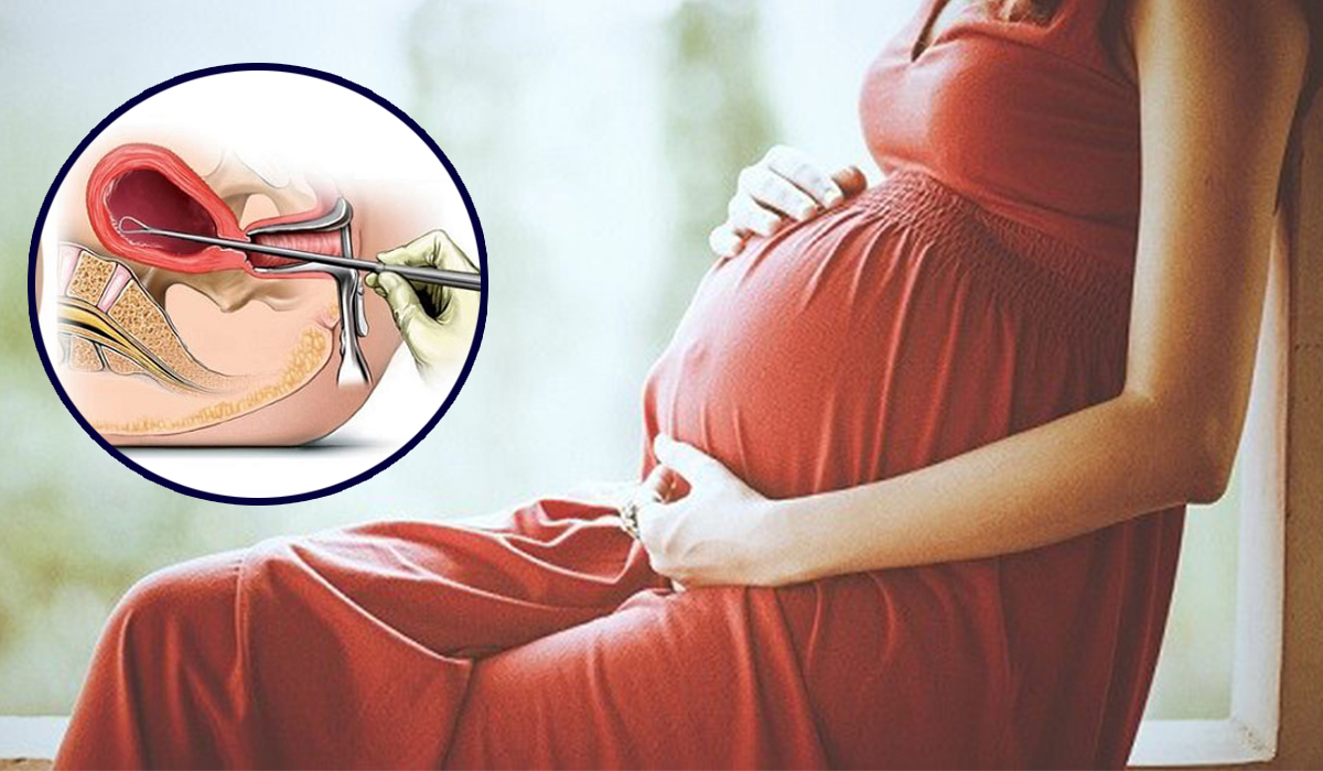 असुरक्षित गर्भपतनले स्वास्थ्यमा जोखिम बढ्दै